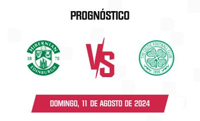 Prognóstico Hibernian x Celtic